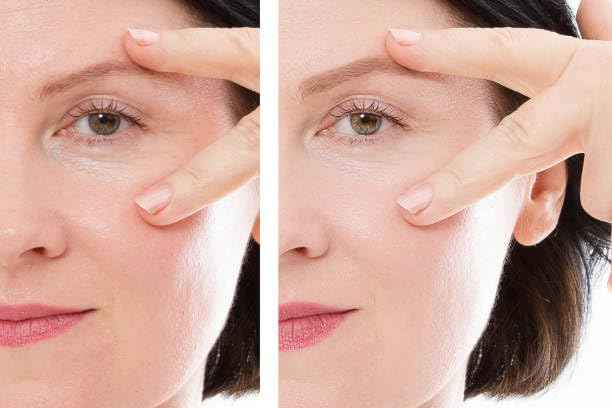 Navensi Bakuchiol Serum 50ml Natural Retinol Alternative with Hyaluronic Acid & Vitamin C Anti-Aging Face Serum for Fine Lines, Wrinkles & Dark Spots Hydrating, Firming & Brightening