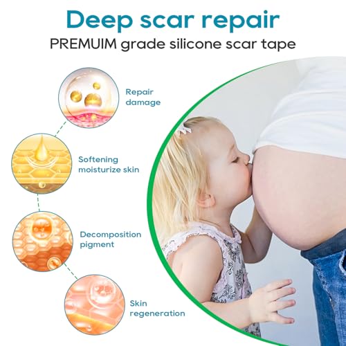Silicone Scar Tape, Silicone Scar Sheets for Surgical Scars (1.6"x 80" Roll-2M), Medical Ggrade Scar Tape for Scars, Keloid, Acne Scars, Burn, C-Section, Stretch Marks Scars Away