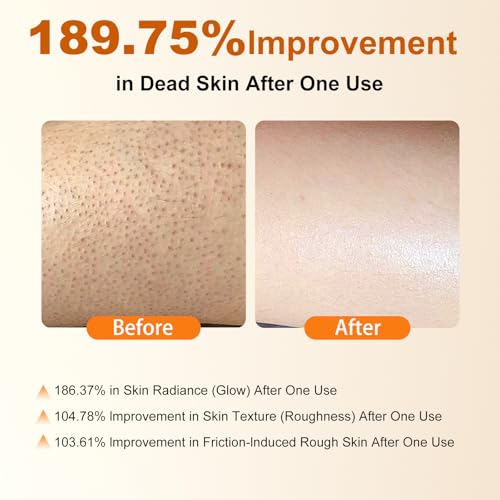 Kojic Acid Turmeric Body Exfoliating Spray 200ml