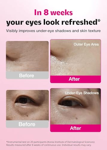 ISOI Blemish Care Eye Patches, 90 Count with Hyaluronic Acid