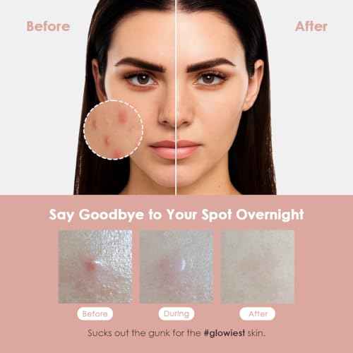 glowiest ASAP Active Spot Alleviating Patch 39 Patches [Daytime] 10mm (1 * 15ea) & 12mm (2 * 12ea) | Premium Hydrocolloid Dressing | Simple & Easy Active Treatment