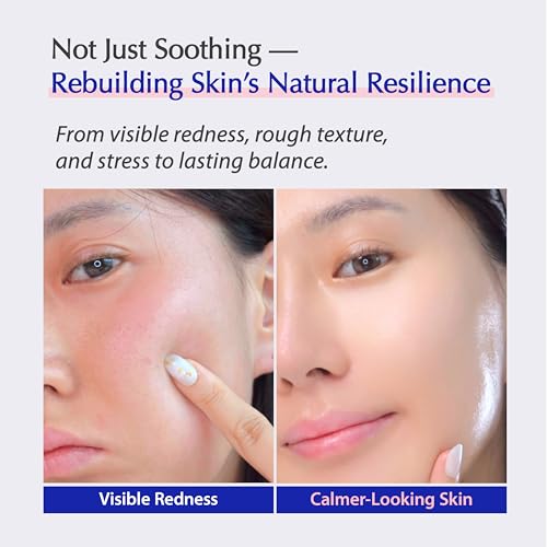 MSM Sulfur-Derived Redness Recovery Cream for Sensitive, Thin Skin ? Probiotic Exosome + Panthenol + Ceramide NP