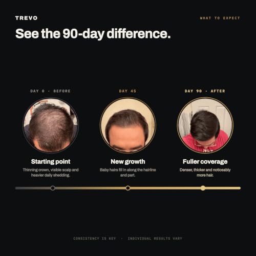 Trevo Micro Infusion System for Fuller, Thicker-Looking Hair