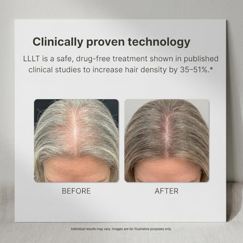 Xtrallux Super Plus Hair Growth Laser Cap - 276 Lasers, FDA Cleared