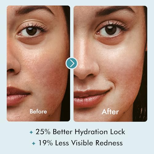 Dermasof Olive Facial Serum with Hyaluronic Acid, Matrixyl 3000 & Peptides, Anti Aging Serum for Face, Hydrating & Calming Formula to Help Relieve Redness & Repair Skin, Made in USA, 1 Fl Oz (30ml)