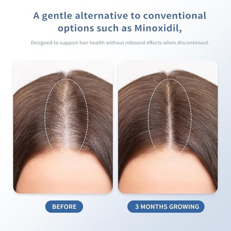 Hair Growth Serum for Thinning Hair - Biotin Roll-On, 30ml