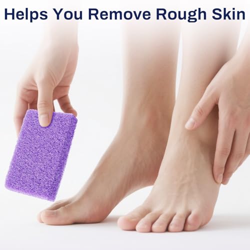 20 Pack Small Pumice Stones for Feet - Exfoliating Foot Callus Remover