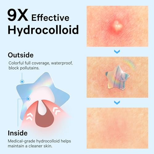 48 Pack Hologram Blue Star & Cloud Acne Pimple Patches with Salicylic Acid — Fun Hydrocolloid Blemish Covers
