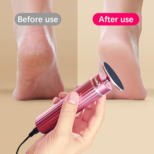 Electric Foot Callus Remover with 80 Sandpaper Discs & Brush
