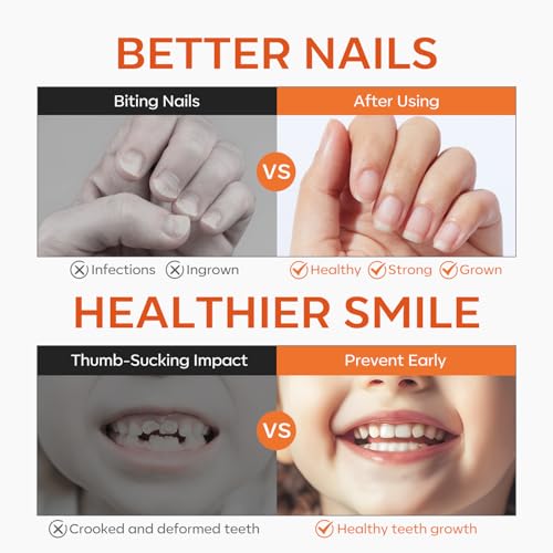 Modelones Anti Nail Biting Polish - Bitter Thumb Sucking Deterrent, 0.48 fl oz