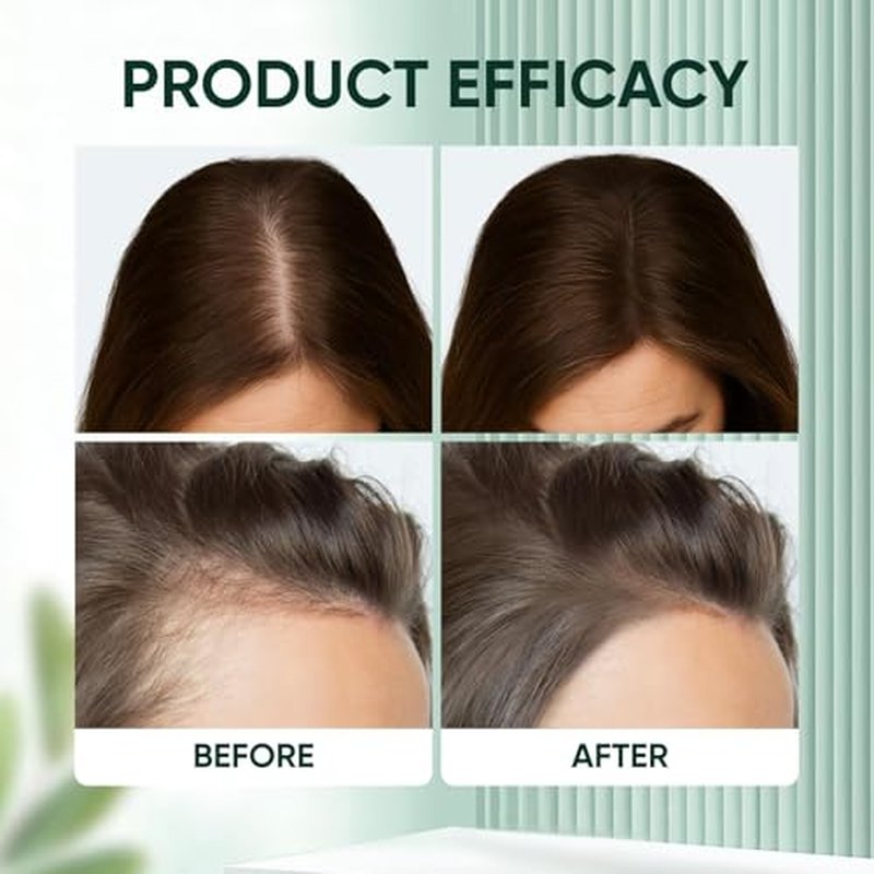 PDRN Hair Growth Ampoule - Nourishing Serum with Ginseng & Soybean