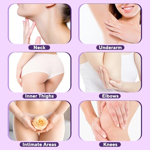 Skin Bleaching Cream, Skin Lightening Cream with Vitamin C for Intimate Areas, Dark Spot Remover for Body, Sensitive, Face, Intimate Areas Underarms, Knees, Elbows, Inner Thighs & Bikini Line,1.7fl OZ