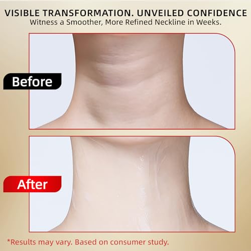 Neck Cream - Retinol & Collagen Neck Firming Cream for Wrinkles, Moisturizing and Anti-Aging, Perfect for Neck & D?collet? Skin Care - 1.76 fl.oz