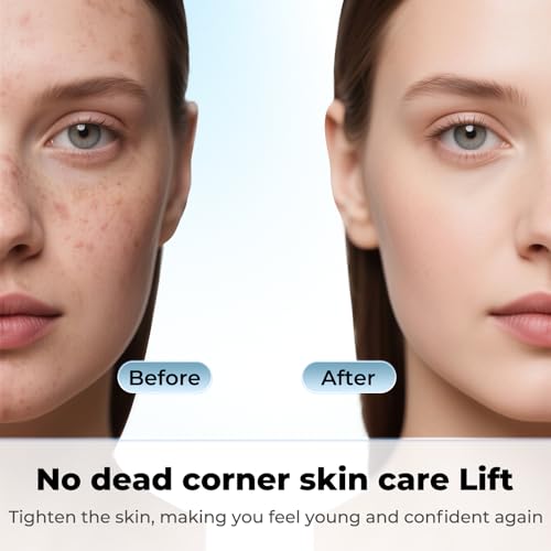 Dual-Head Blackhead Remover Tool - Pore Cleaner for Nose & Face