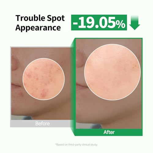 PONGDANG Pore Deep Clean Bubble Cleanser | 5.11 fl. oz | Acne-prone & Sensitive Skin Formula