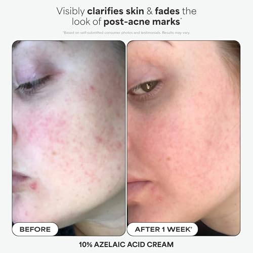 Paula's Choice Favorites Mini Kit, 4 Piece Set Includes 2% BHA Exfoliant, 1% Retinol Treatment, 10% Azelaic Acid Booster, Youth Extending SPF 50 Moisturizer, Travel Skin Care Set for Glowing Skin