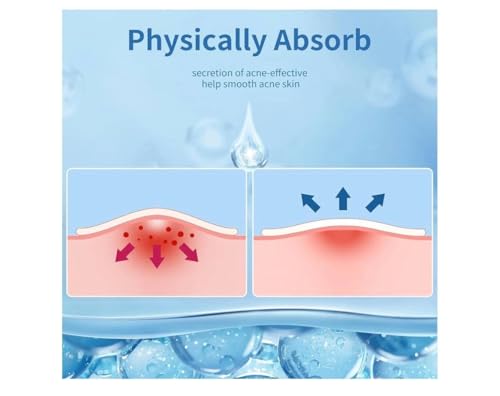 Acne Patches 300 Count Hydrocolloid Pimple Patches 4 Sizes