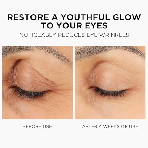 MOMOHOO Retinol Caffeine Under Eye Cream ? Anti-Aging Eye Cream with Soluble Collagen for Puffiness, Wrinkles, and Under-Eye Bags, Hydrating & Soothing Formula for Women (0.68 fl. oz)