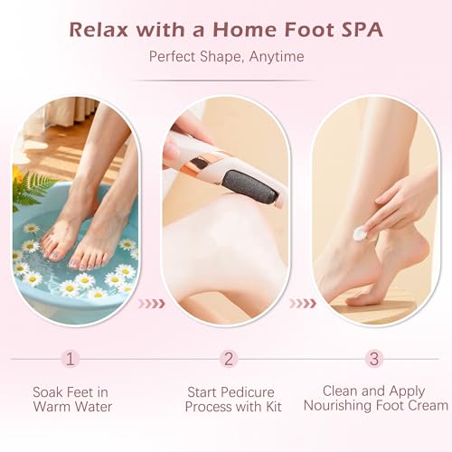 Rechargeable Electric Callus Remover for Smooth Feet - 2 Gears & 2 Rollers