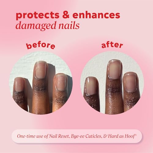 Onyx Professional Nail Repair Pen - Nourishing Treatment for Damaged Nails, 0.13 fl oz