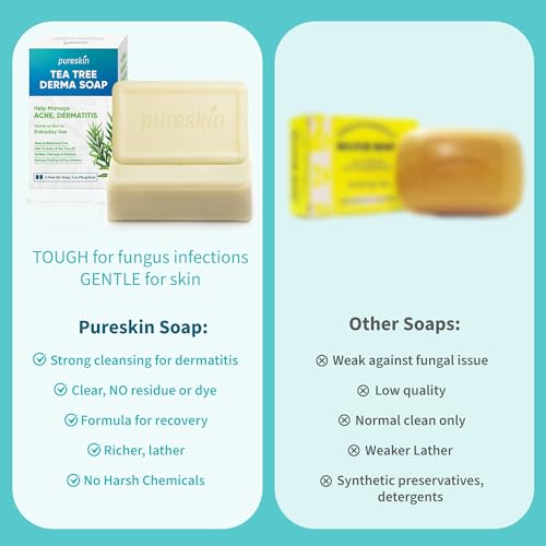 PURESKIN Sulfur & Tea-Tree-Oil Soap Bar: Natural Balanced Cleansing for Oily, Acne Dermatitis-Prone & Irritated Skin ? Helps Reduce Body Odor & Blemishes ? 2 Pack
