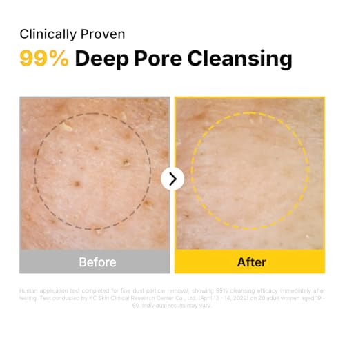 MANYO Pure Cleansing Oil | Makeup Remover & Blackhead Control