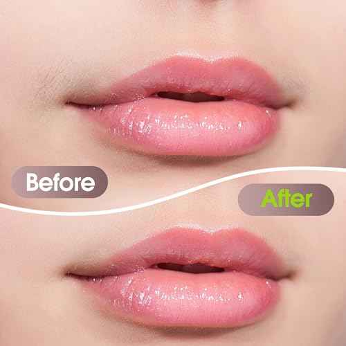 Facial Hair Removal for Women: Electric Hair Removal Device - Rechargeable Painless Face Razor for Chin Upper Lip Peach Fuzz with Light Gifts for Women(Rose Gold)