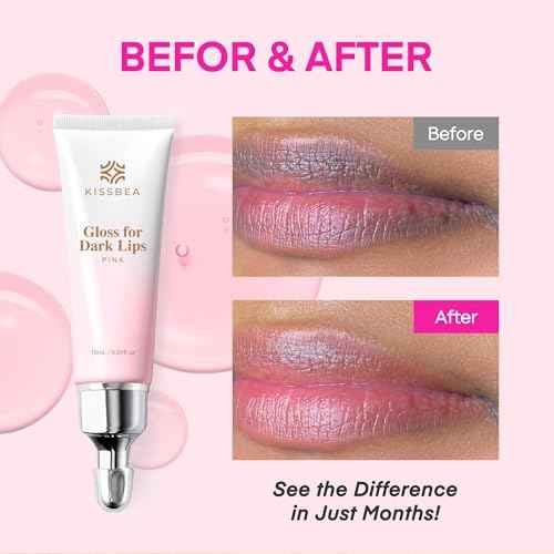 Lip Lightening for Dark Lips: for Smokers, Dry or Uneven-Toned Lips ? Restores Natural Look & Moisture with VC, Lemon Peel & Licorice ? Refreshing Mint Scent ? 15 mL