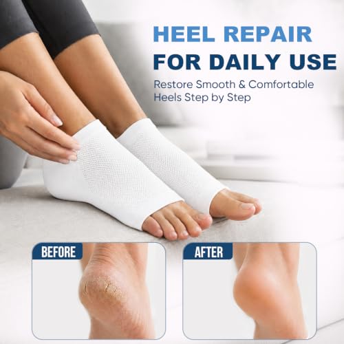 Moisturizing Heel Socks for Cracked Heels - 2 Pairs, Toeless Gel