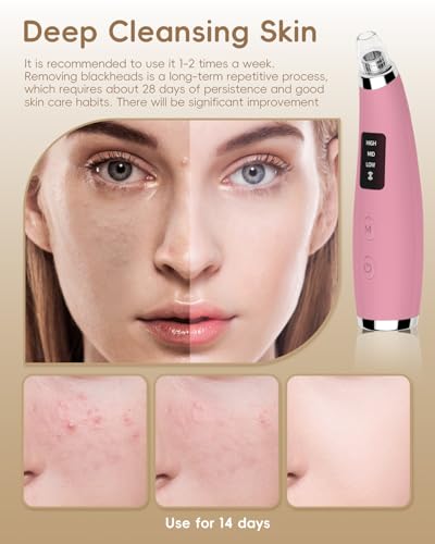 Pore Vacuum Blackhead Remover - 5 Attachments & 3 Suction Levels