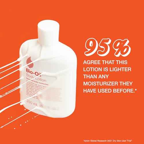Bio-Oil Moisturizing Body Lotion for Sensitive and Dry Skin, Ultra-Lightweight, Fast Absorbing Moisturizer with Jojoba, Rosehip, Shea Oil and Hyaluronic Acid, Non-Comedogenic, 8.5 Oz