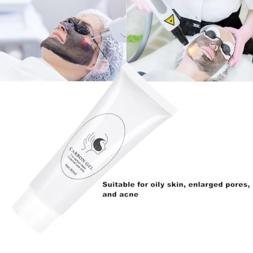 ABBASI & CO 3X Carbon Peel Gel 80ml - Deep Cleansing Facial Mask for Blackhead Removal & Skin Rejuvenation, for All Skin Types, Infused with Marine Minerals & Vitamins - Pack of 3