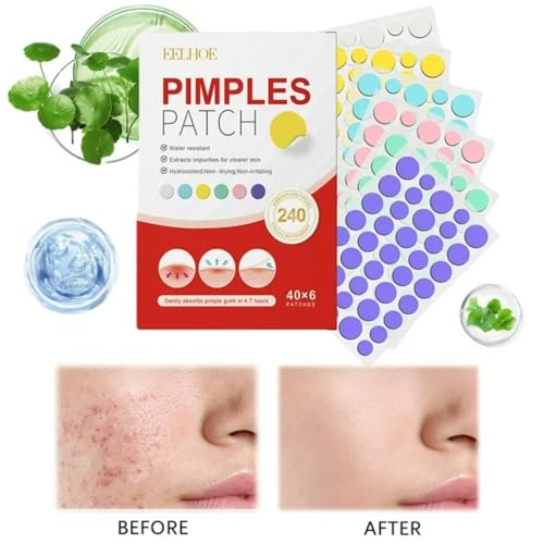 240 Acne Pimple Patches – Hydrocolloid Spot Stickers Waterproof
