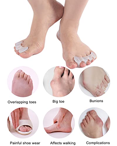 Silicone Toe Separators & Spacers for Bunion & Hammertoe Relief (2 Pairs)