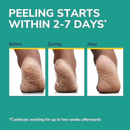 Dr. Scholl's Ultra Exfoliating Foot Peeling Mask with Urea, 3 Pairs
