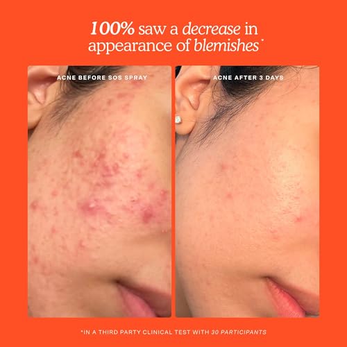 Tower 28 SOS Recovery Hydrating Face Cream - Sensitive Skin