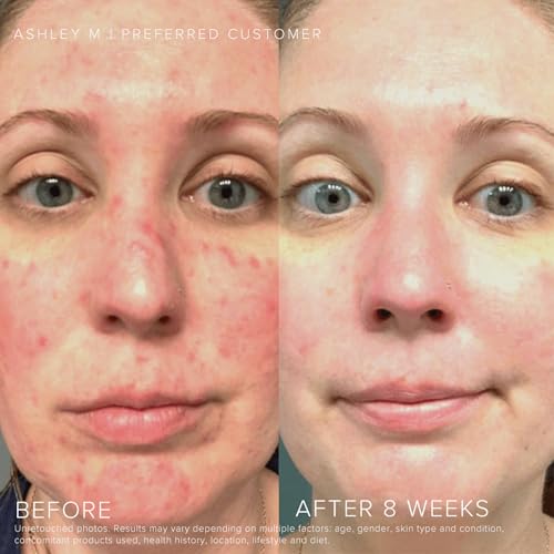 Rodan + Fields Soothe Daily Mineral Sunscreen SPF 30 | 1 Fl Oz | SPF Moisturizer for Face | Zinc Oxide Sunblock | Travel Size Sun Protection Skincare