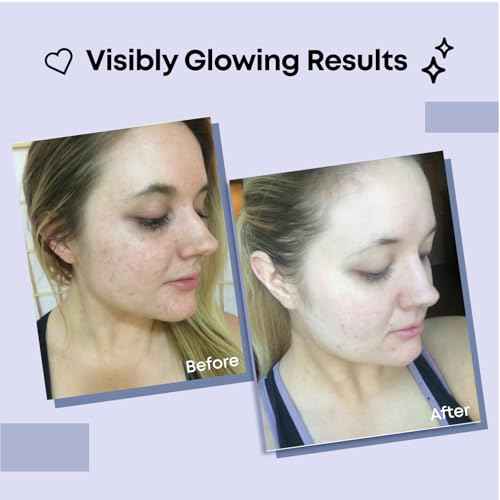 Collagen Face Mask | Hydrating Beauty Skincare Face Mask for Glass Skin, Revitalizing Overnight Collagen Facial Mask for Wrinkles, Selfcare Sheet, Moisturizing Facial Skin Care Product for Women & Men