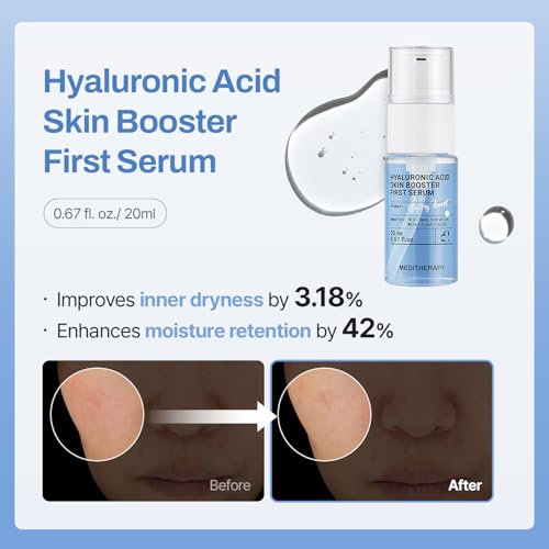 Meditherapy Gentle Boost Kit ? Korean Skin Care Set with Retinal & Hyaluronic Acid Serum & Squalane Moisturizer, Anti-Aging & Hydrating Routine, Beginner-Friendly, Travel & Gift
