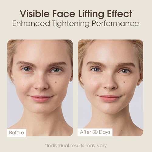 Intelligent Jawline Shaper Double Chin Reducer and V-Face Lift Belt Machine with Remote Control, Face Massager V-Face Device for Women