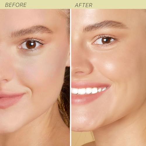 Beauty by Earth Hyaluronic Acid Moisturizer and Serum for Face - USA Made with Organic & Natural Ingredients