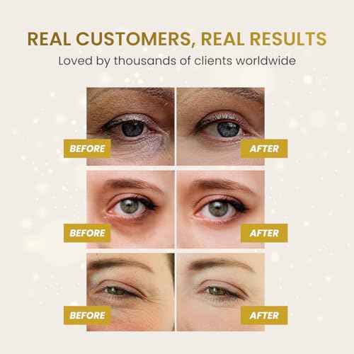 PLANTIFIQUE Gold Eye Patches for Puffy Eyes and Dark Circles 5 Pairs Under Eye Masks for Dark Circles and Puffiness Eye Gels with Collagen & Caffeine Eye Patches Gold Eye Mask Skincare