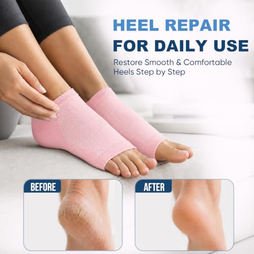 OKbutler Pink Moisturizing Heel Socks for Cracked Heel Treatment - 2 Pairs