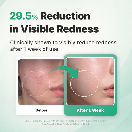 FORETDERM Peptide Face Cream with EGF & CICA - Sensitive Skin Moisturizer