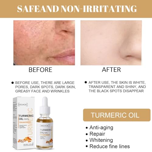 3PCS Turmeric Dark Spot Corrector Serum Oil, Repair Face Serum, Natural Turmeric Skin Dark Spot Skin Care Moisturizing Repair for Face & Body(30ml)