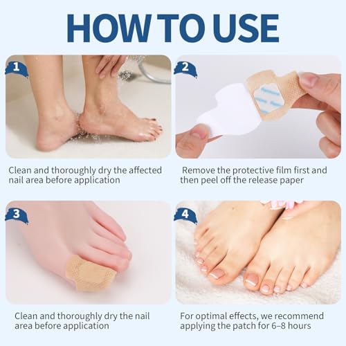 TEAWOO 50-Pack Overnight Toenail Repair Patches for Damaged Nails