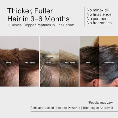 Fléur Copper Peptide Hair Growth Serum for Thinning Hair - Non-Greasy, Lightweight Formula for Fuller, Stronger Hair
