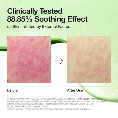 Anua Azelaic 10 Hyaluron Redness Soothing Pad, Troubled & Spot Care with Korean toner pads, Quick & Easy Stretchable Facial Mask with Azelaic acid, Hyaluronic Acid, Korean Skin Care (90 pads)