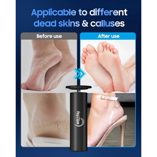 FSA&HSA Electronic Foot File,Callus Remover for Foot - Dead Skin Removal,Foot Scrubber with 60 Pcs Sandpaper Discs- Effortless Soft Smooth Skin in Minutes,for Women & Men