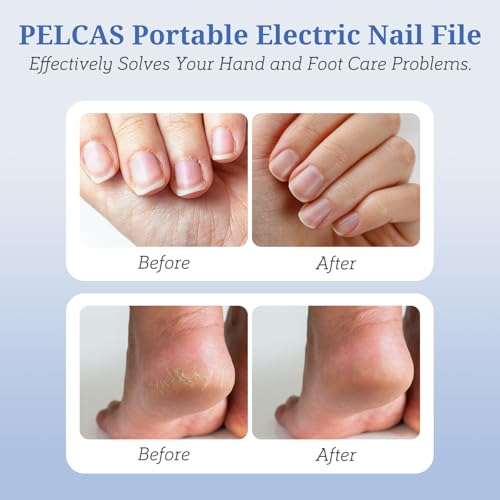 Electric Nail File Kit - Cordless Manicure & Pedicure with 5 Speeds & LED Light